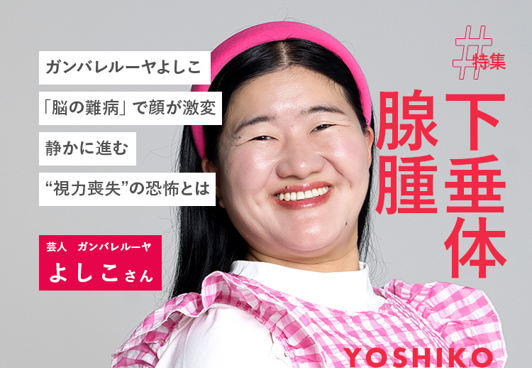 ガンバレルーヤよしこ「脳の難病」で顔が激変。静かに進む“視力喪失”の恐怖とは